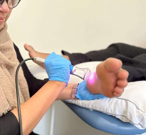 Illustration of laser treatment being applied to a foot.