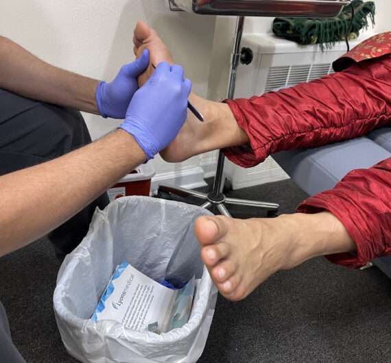 Alam Podiatry Callus Removal Alam Podiatry Callus Removal - Expert Foot Care