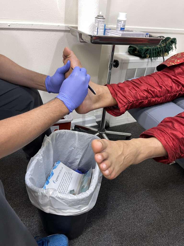 Alam Podiatry Callus Removal - Expert Foot Care