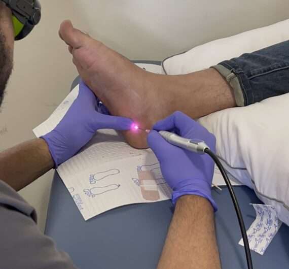 Alam Podiatry Laser Foot Treatment - Advanced Podiatric Care