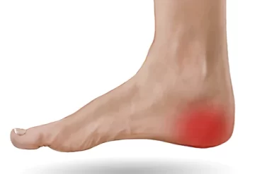Heel Pain Solutions