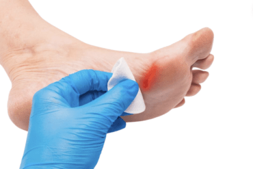 Wound Care Management