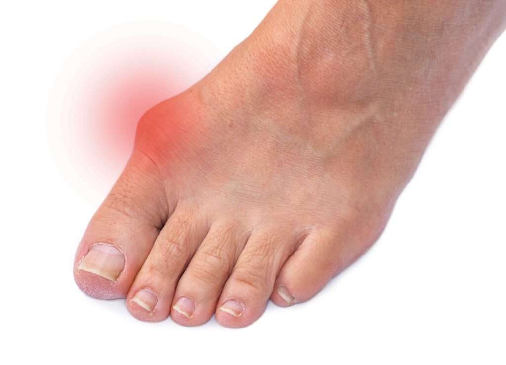 Laser Foot Treatment Procedure