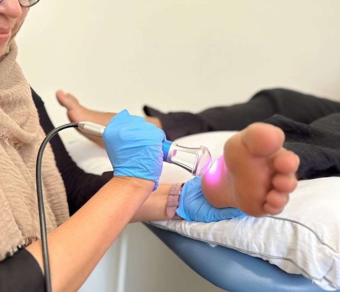 Illustration of laser treatment being applied to a foot.